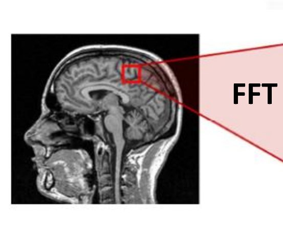 FFT